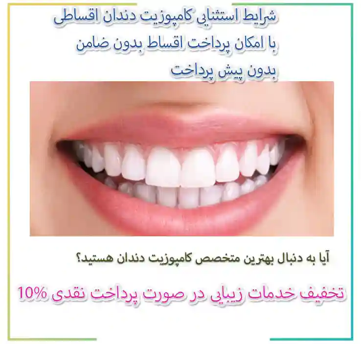 کامپوزیت دندان اقساطی